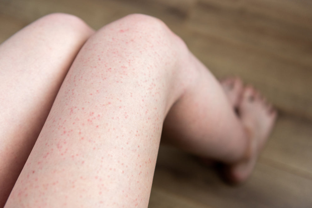 How to Care for Your Skin After Shaving: Tips That Really Work